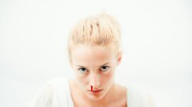 Bloody Nose Bleed