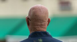 Hair Loss